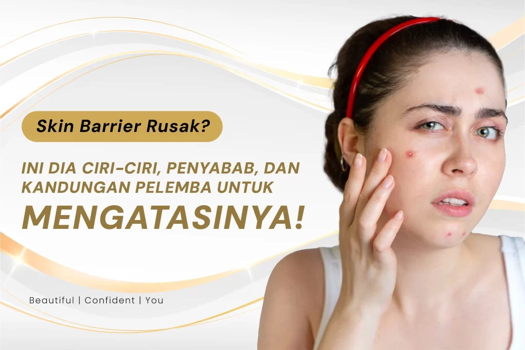 Skin Barrier Rusak? Ini Dia Ciri-ciri, Penyabab, dan 4 Kandungan Pelembap untuk Mengatasinya!