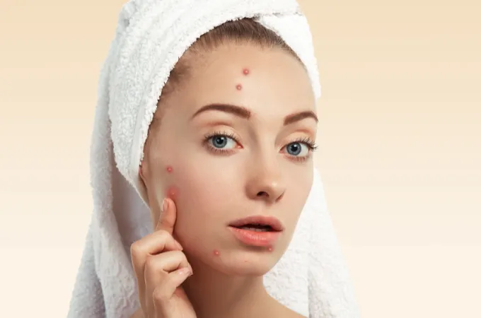 skincare untuk kulit kusam